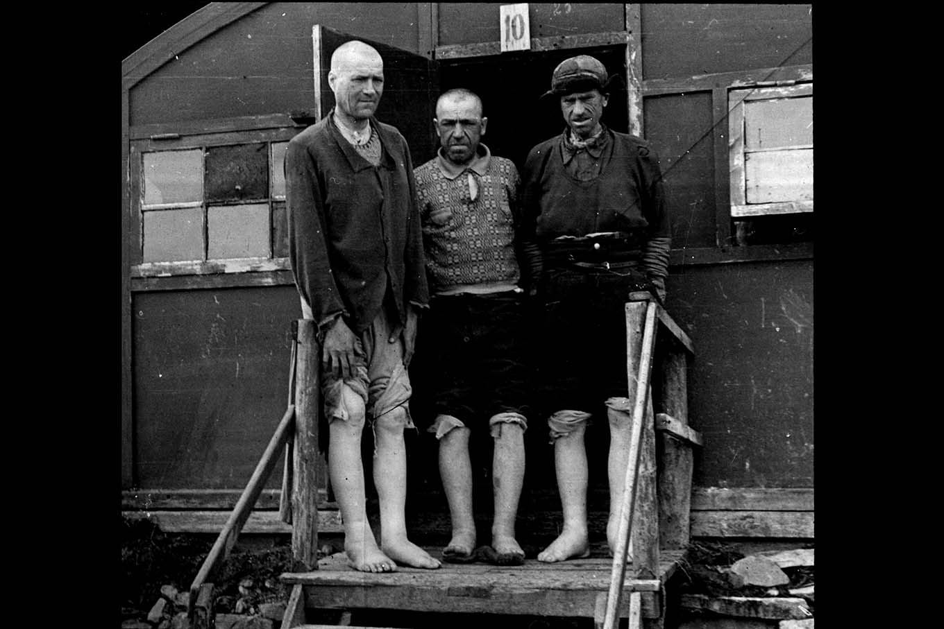 Forced laborers with swollen legs in front of a barracks. Photo. 