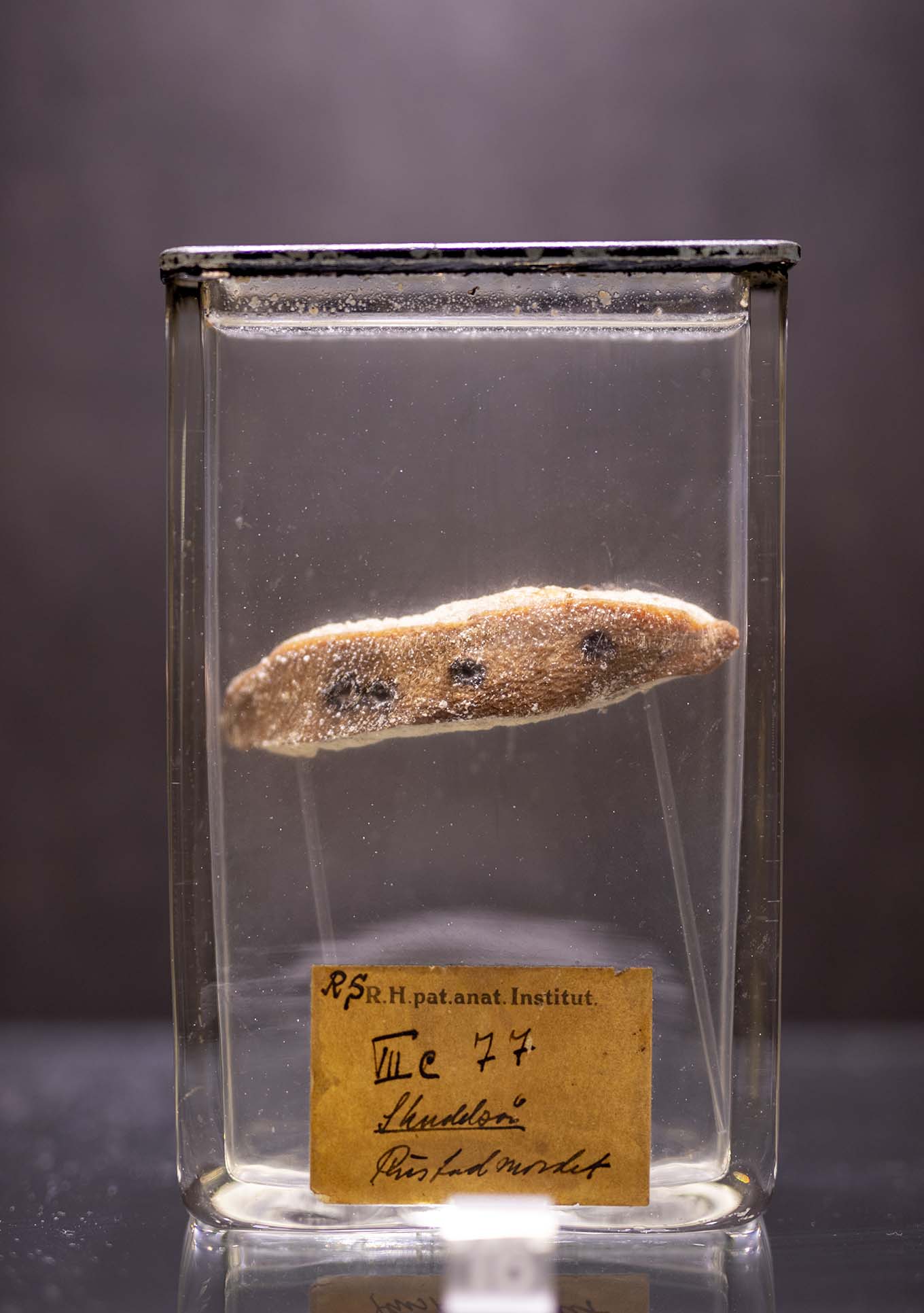 Hudstykke med skuddsår på glass. Foto.