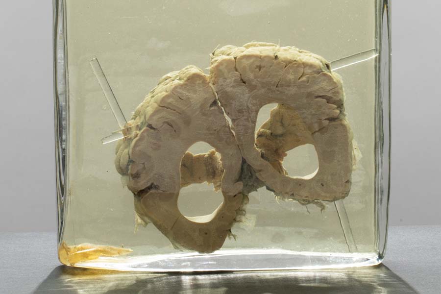 A cross-section of a human brain inside a glass box.