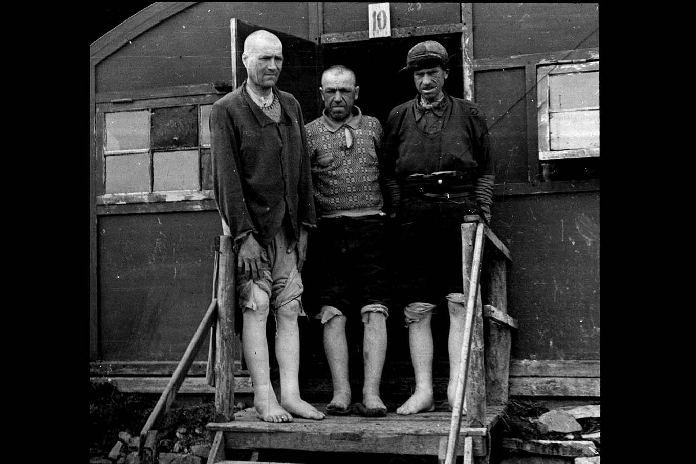 Tvangsarbeidere med hovne bein foran en brakke. Foto.